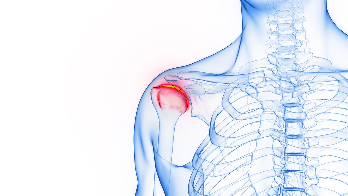lesion hombro accidente trabajo